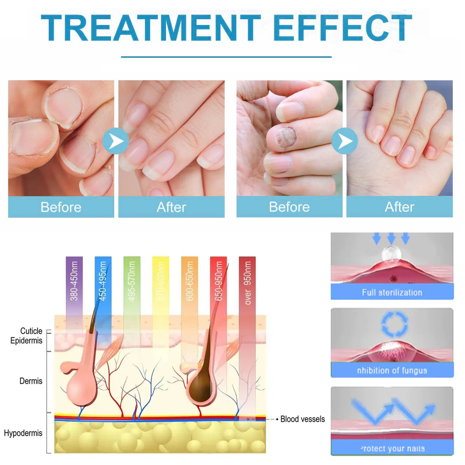 Fungal Treatment, Ingrown Toenails and Strengthening of Fingernails and Toenails