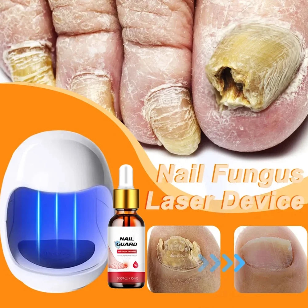 Fungal Treatment, Ingrown Toenails and Strengthening of Fingernails and Toenails
