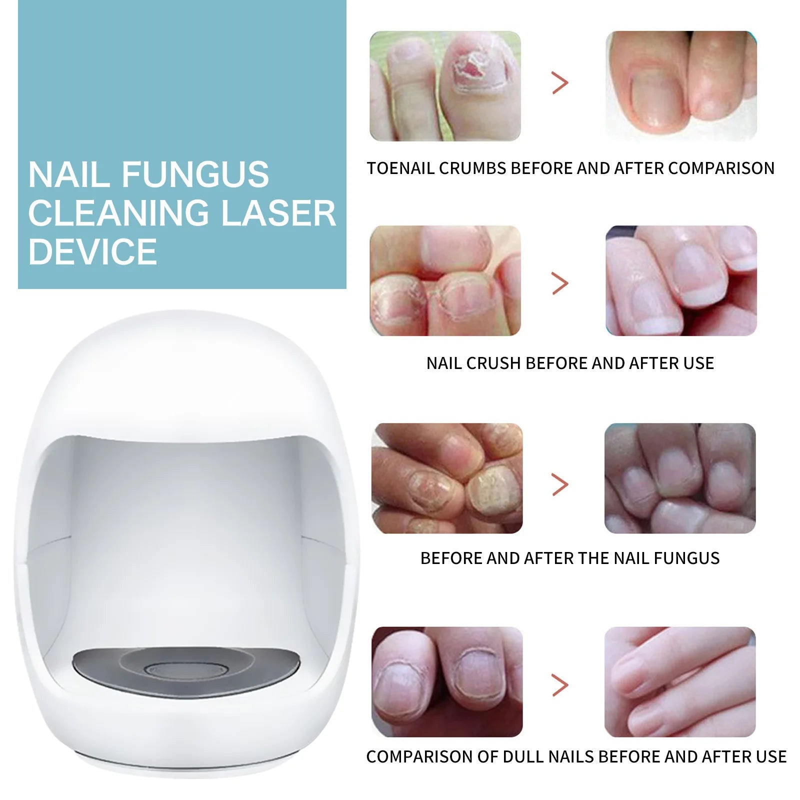 Fungal Treatment, Ingrown Toenails and Strengthening of Fingernails and Toenails
